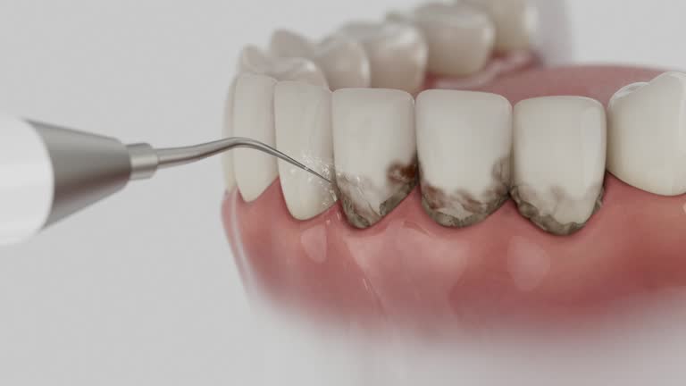 Trusted Emergency Dentist service in Olyphant, PA - Dentist Open Now